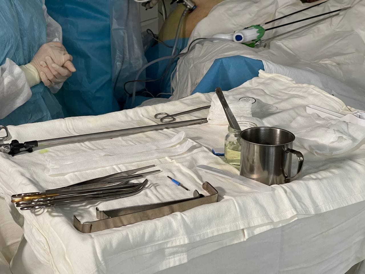 Врачи из&nbsp;онкоцентра Челнов впервые провели операцию по&nbsp;удалению опухоли лапораскопическим путем