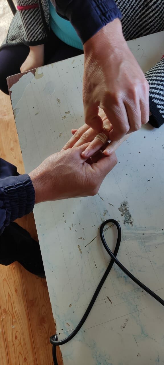 В Татарстане спасатели «дедовским способом» сняли застрявшее на пальце кольцо
