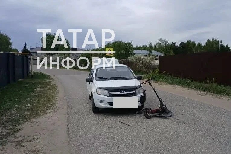 В Татарстане ребенок на самокате попал под машину и получил перелом