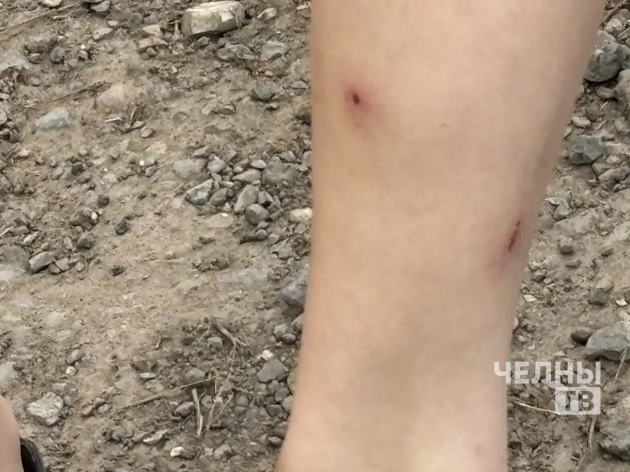 Татарстан атаковали комары: нашествие связали с погодой