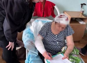 Напавшие на пенсионерку собаки в Зеленодольском районе оказались хозяйскими