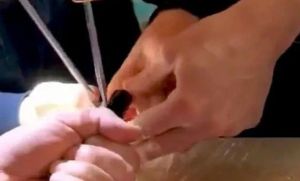 В Казани спасатели освободили палец пятилетнего мальчика из стула