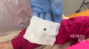 В Челнах с начала сезона клещи покусали почти 250 человек